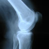 xray-scans-thumb mobile xrays manchester