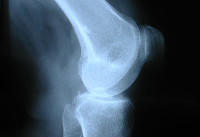 mobile xrays scans manchester